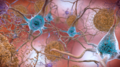 Beta-Amyloid Plaques and Tau in the Brain