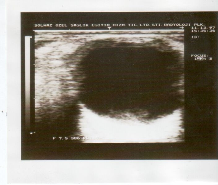 File:Ultrasound Scan ND 258.jpg