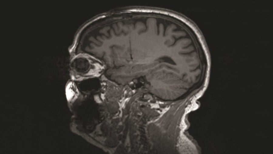 Scientists have located the brain region responsible for pessimism