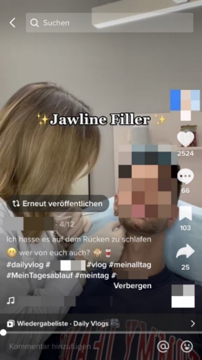 Ärztin spritzt männlichem Jugendlichen etwas außen in den Kiefer. Darüber steht "Jawline Filler", also Kieferlinie-Unterspritzung