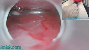 Raw Asian Creampie and Womb Cam Insemination