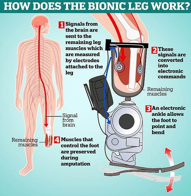 As this diagram shows, the bionic legs works by recording the signals from remaining muscles and converting them into commands for an electronic ankle