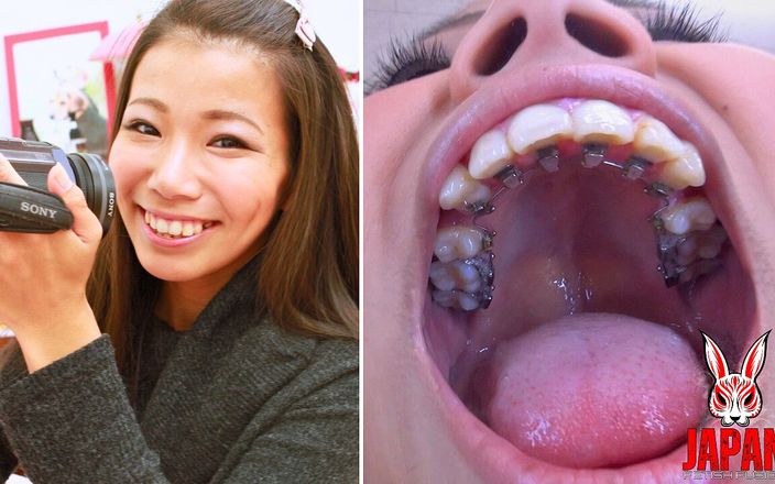 Japan Fetish Fusion: Ortodontické zuby fetiš: Dentální fantazie Izumi Asato