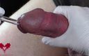 Close Up Extreme: Perfect Extraction of Sperm Directly From the Urethra. Close-up of...