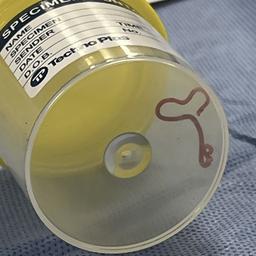 Ein Wurm in einem medizinischen Becher.