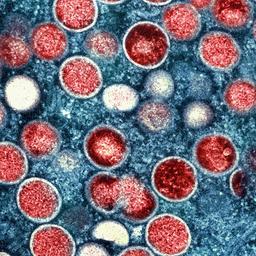 Eingefärbte Transmissionselektronenmikroskopaufnahme von Affenpockenpartikeln (rot) in einer infizierten Zelle (blau).