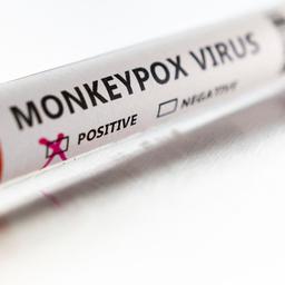 Ein Röhrchen mit dem Label "Monkeypox Virus positive" (Illustration)