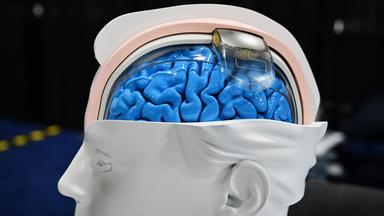Model eines Gehirnimplantats