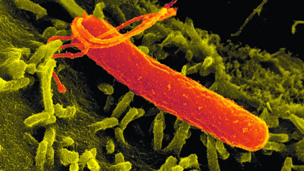 Bakterium Helicobacter pylori