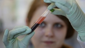 Abgeordnete stellen sich gegen Bluttestroutine für Schwangere