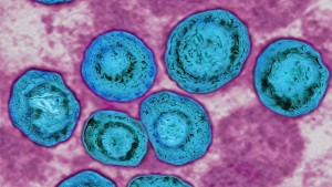 Erster Schritt zu Impfung gegen Cytomegalievirus