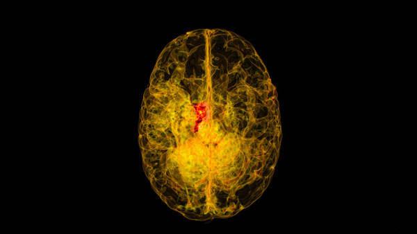Gewitter der Neuronen: So bringt ein Kuss ein Gehirn zum Leuchten.