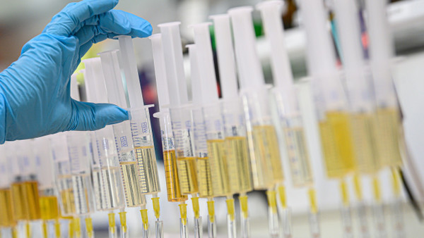 Urinproben stehen im Labor für erweiterte Dopingkontrollen bereit.