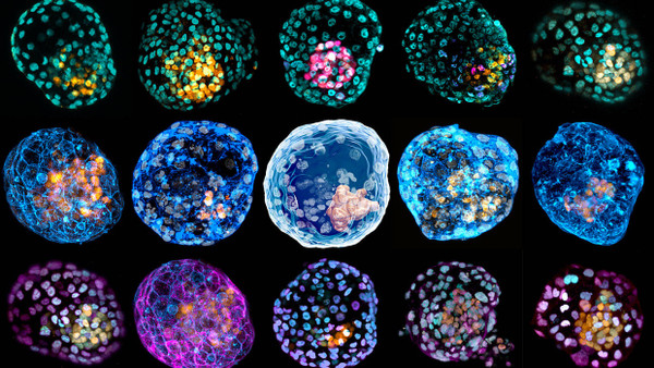 Im Labor gezüchtete Blastozysten. Aus den Zellkugeln können sich nach dem Einnisten in der Gebärmutter Embryonen entwickeln. Jeder Zelltyp ist unterschiedlich eingefärbt.