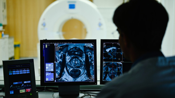 Im Kontrollraum des Deutschen Krebsforschungszentrum in Heidelberg: Zu sehen ist das Querschnittsbild einer Prostata.