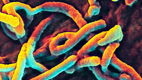 Mikroskopaufnahme des Ebolavirus