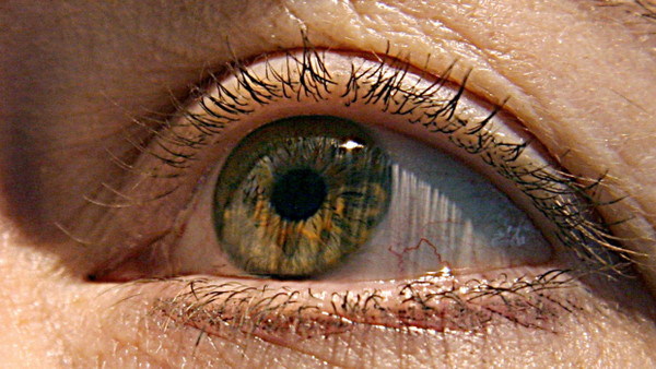 Die Dicke der Netzhaut-Schichten im Auge soll auf ein erhöhtes Parkinson-Risiko hindeuten.