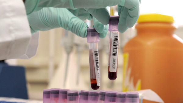Die Zahl der anerkannten Anti-Doping-Labore ist weltweit zu gering.